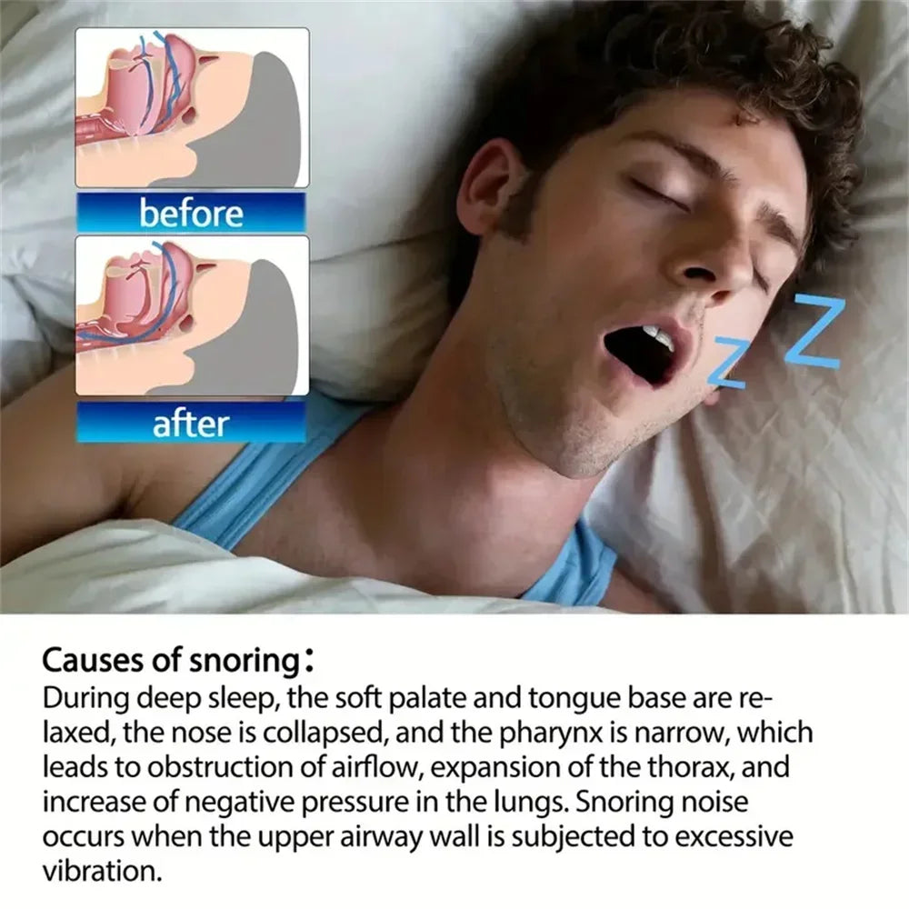GlowifyCare Comfort Breathing Nasal Strips (50-200pc) | Physical Airway Expansion for Deep Sleep